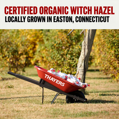 Unscented Alcohol-Free Witch Hazel Facial Toner for Dry Skin, 8.5 Fl Oz