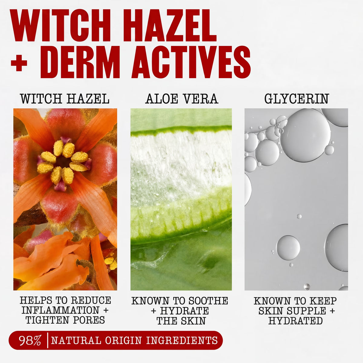Unscented Alcohol-Free Witch Hazel Facial Toner for Dry Skin, 8.5 Fl Oz