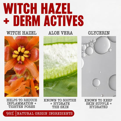 Unscented Alcohol-Free Witch Hazel Facial Toner for Dry Skin, 8.5 Fl Oz