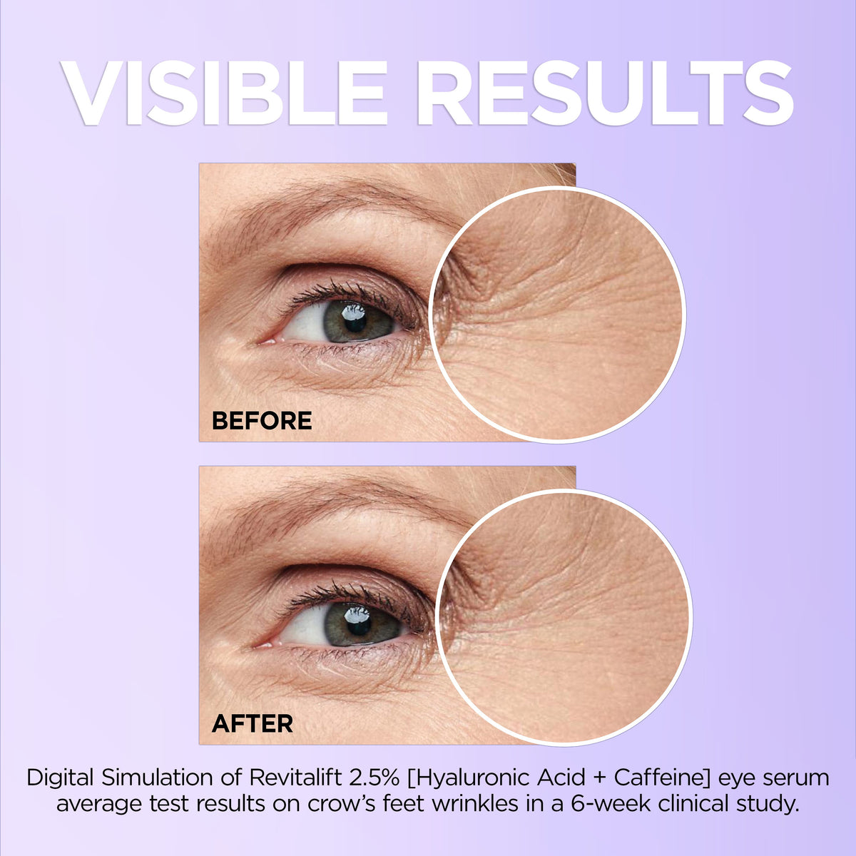 Revitalift Caffeine Eye Serum for Dark Circles, 0.67 fl oz