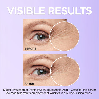Revitalift Caffeine Eye Serum for Dark Circles, 0.67 fl oz