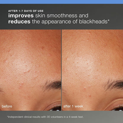Unlock Radiant Skin with the Dermalogica Healthy Skin Discovery Kit - Your 4-Piece Travel Essential