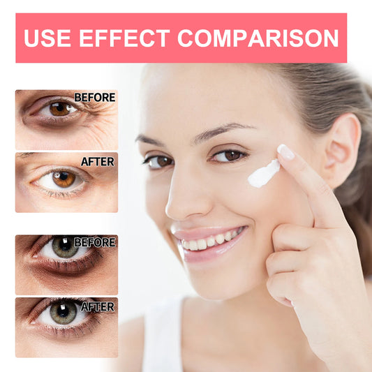 Revitalize Your Eyes: Retinol Eye Cream Stick for Dark Circles, Puffiness, and Youthful Firmness